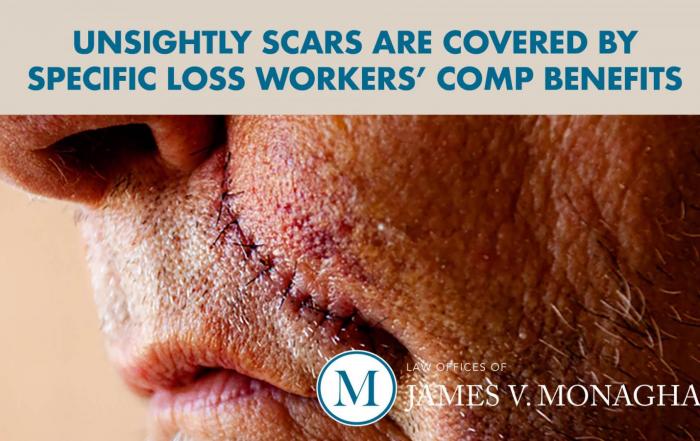 scarred face and specific loss benefits